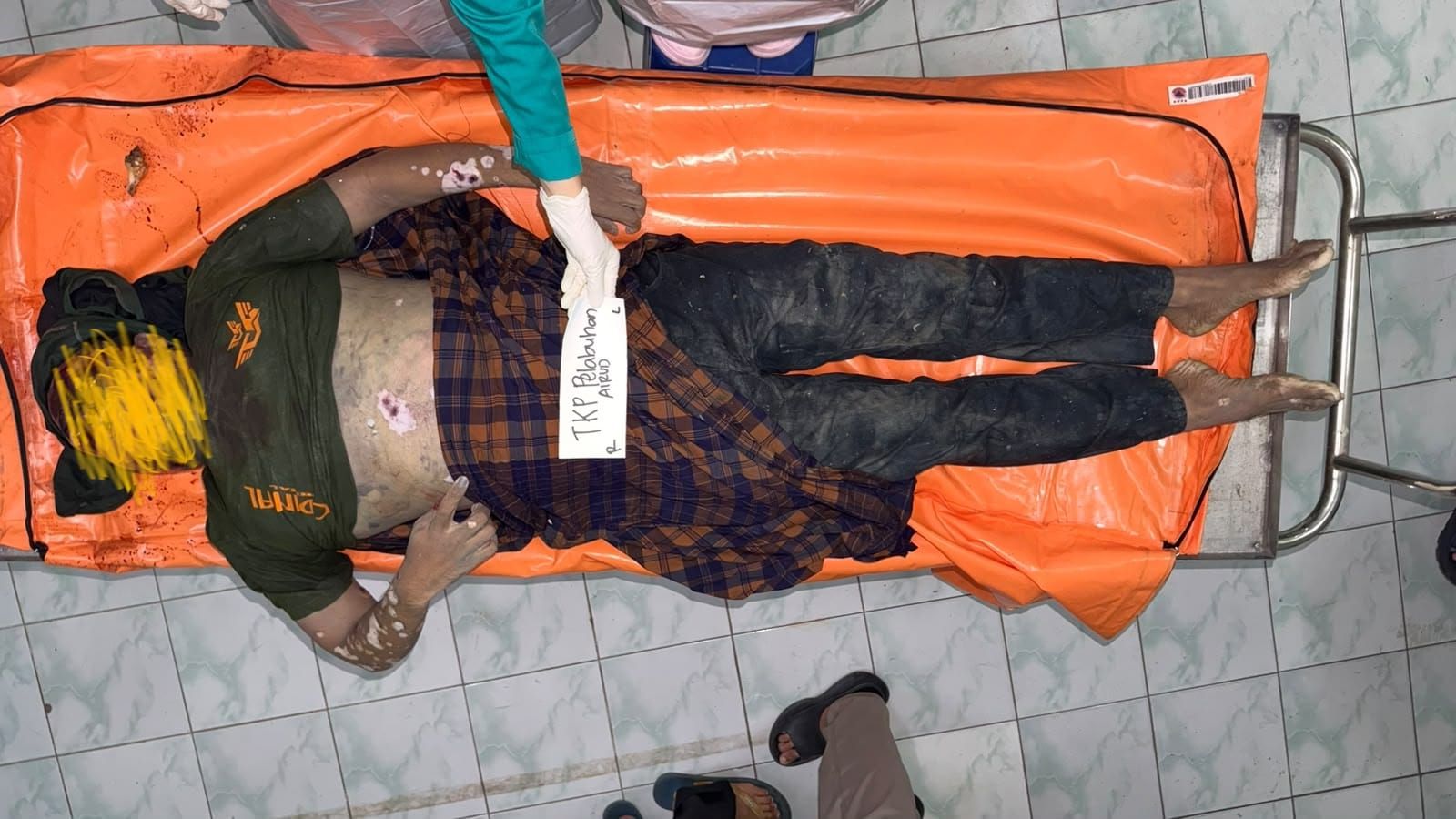 Identitas Belum Diketahui, Jenazah Pria Berkaos Hijau Berada di RSUD Ibnu Sina Gresik